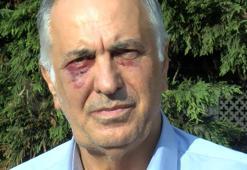 Kartal Cemevi Başkanı’na saldırı soruşturmasında 9 gözaltı