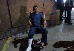 Mardin'deki katliam gibi kazadan yaralı kurtulan vatandaş dehşet anlarını anlattı