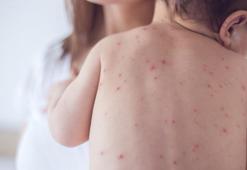 Yeni salgın mı başlıyor? Yeni virüs domates gribi nedir? Domates gribi belirtileri neler, tedavisi var mı?