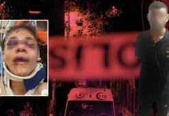 İzmir'de dini nikahlı eşini 51 yerinden bıçakladı!