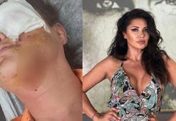 Tuğba Altıntop, köpek saldırısına uğradı