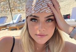 Survivor Aycan Yanaç son pozuyla olay oldu! 'Estetiği fazla kaçırmışsın'