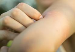 Türkiye risk altında! 'Dünyanın en tehlikeli hayvanı' diyerek uyarıyı yaptı