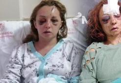 Erkek arkadaş dehşeti hayattan kopartıyordu! Mezarlığa götürüp dövmüşler