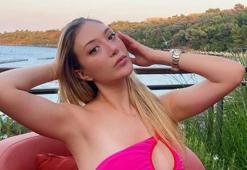 Yasmin Erbil'den estetik itirafı! 'Yüzüne ne yaptın?'