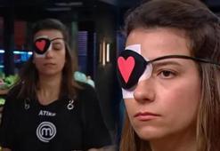 MasterChef Atike'nin gözüne ne oldu? MasterChef Atike'nin gözünde görme kaybı var mı?