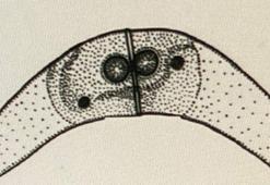 Dünyada daha önce hiç görülmemiş! Kalkan balığında keşfedildi