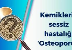 Kemiklerin sessiz hastalığı ‘osteoporoz’
