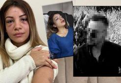 Koca dehşeti! 4 aylık hamile karısını çocuğunun gözü önünde dövdü