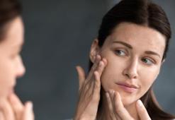Cildi soğuktan korumada nemlendirici kadar etkili! Sakın bunu yapmayın