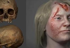 Cinsel hastalık kafatasını yedi! Ölmeden önce nasıl göründüğü ortaya çıktı