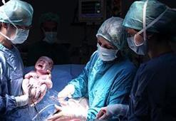 'Küçük savaşçı' dünyaya merhaba dedi! Kimse inanamadı, hastane özür diledi