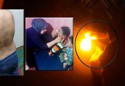 Ağzını bantlayıp çakmakla vücutlarını yaktı! Anne babanın yaptığı işkence dehşete düşürdü