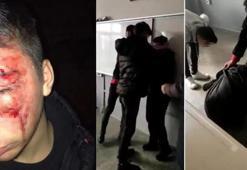 Lisedeki rezaletin ardından bir darp daha! Soruşturma başlatıldı