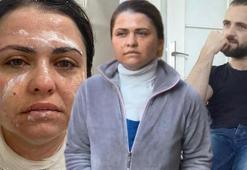 Eski eşine kimyasal madde ile saldırdı! 'Güzelliğine mi güveniyorsun?'