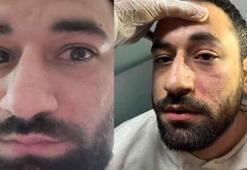 Randevuya geç kalıp, doktoru darbetti! Hasta hakkındaki gerçeği polislerden öğrendi