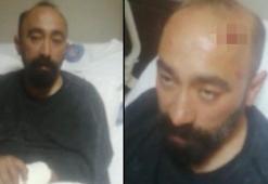 Müşteri gibi bindi, taksi şoförünü hastanelik etti! 'Boş araziye gitmek istiyorum'