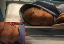 Doğumhanede dehşet! Doktor bebeğin başını neşterle kesti