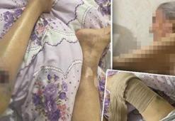 91 yaşındaki kadına bakıcı dehşeti! Yaşlı kadın hastanede ölüm kalım savaşı veriyor