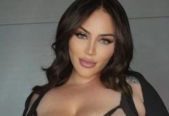 Dünyaca ünlü model göğüslerinin büyümesini durduramıyor! Gören estetik sanıyor ama gerçek başka