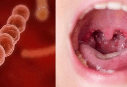 İşgalci şekle bürünen “Streptokok A” bakterisinde ölüm riski