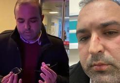 Arkadaşıyla yemeğe giden avukat, müşteriler tarafından darp edildi