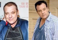 Ünlü oyuncu beyin anevrizması geçirdi!