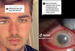 Lens ile uyudu, hayatı kabusa döndü