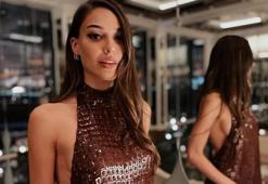 Dilan Çiçek Deniz estetiksiz haliyle gündemde!