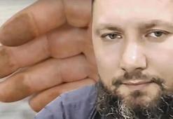 Yakalanmamak için parmak izlerini eritti, estetik ameliyat oldu! Yıllardır aranan cani yakalandı