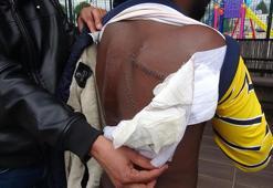 Yunan askerleri sırtından bıçakladı, tam 30 dikiş atıldı