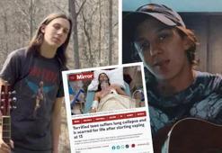 Zararsız diye başladı hayatının kabusu oldu! Elektronik sigara yüzünden akciğeri tam 4 kez söndü...