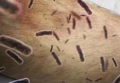 Sessiz pandemi "Lyme" 350 hastalığı taklit ediyor! 10 milyon kişide var