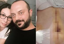 Eşini 6 yerinden bıçakladı! 'Beni makasla yaraladığında affettim, o da affetsin'