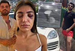 Mankene gece kulübünde eski sevgiliden öldüresiye dayak!