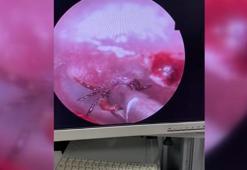 Kulak ağrısıyla hastaneye gitti, korkunç gerçek ortaya çıktı! Uzmanlar uyardı: Artarak devam edecek