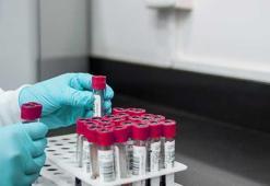 İngiltere’de bulaşıcı cinsel hastalıklar rekor seviyeye yükseldi