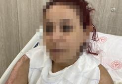 Gece kulübünde dehşet anları: Genç kız bir anda alev topuna döndü