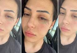 Güney Kıbrıs Rum Kesimi’nde saldırıya uğrayan Asya Karaali’nin duruşması 6 Temmuz’da yapılacak