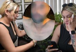 Üzerine içki döküp yakmaya çalışmıştı! Boşandı ama kabus sürüyor