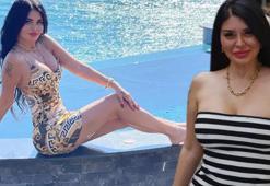 Ebru Polat'tan estetik yanıtı: Doğuştan gelen bir güzelliğim var