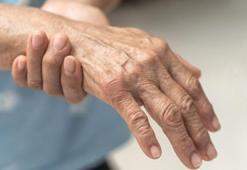 Bu belirtilere dikkat! Tedavisi yok ama durdurmak mümkün, Dünyada 6.1 milyondan fazla kişide var!