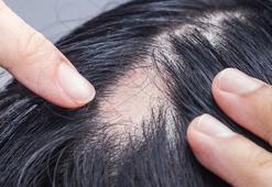 Saçkıran nedir? Sarımsak ile ilgili doğru bilinen gerçek ortaya çıktı