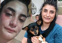 Hamile kadına ‘köpekle neden markete geldin’ şiddeti: Düşük yaptım