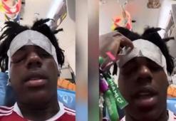 Küme Baş Ağrısı (Cluster Headache) nedir, ölümcül müdür? iShowSpeed’e ne oldu, Küme Baş Ağrısı neden olur, Cluster Headache tedavisi nasıl yapılır?