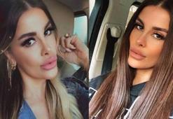 Oyuncu Tuğçe Özbudak kısmi felç geçirdi! Ameliyat öncesi dua istedi