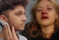 İstanbul'da sokakta vahşet! Genç kızın yüzüne taşla vurdular, arkadaşının kulağını kestiler