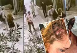 Taksim’de genç çifte çivili sopalı saldırı! Öldüresiye dövdüler