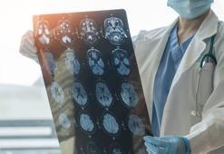 Dünyada 6.1 milyon insanı etkileyen dejeneratif hastalık! Tedavisi yok, ama durdurmak mümkün! Belirtiler şaşırtıcı…