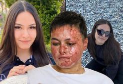 Liseli Beyzanur'un hayali olan iş hayatını kararttı! "Yeniden devam etmek istiyorum"